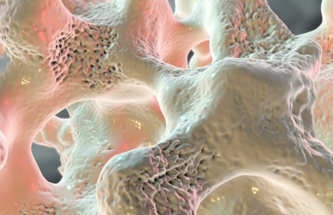 Prevenzione Osteoporosi 01