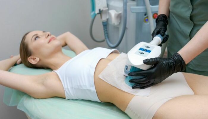 Crioterapia Estetica