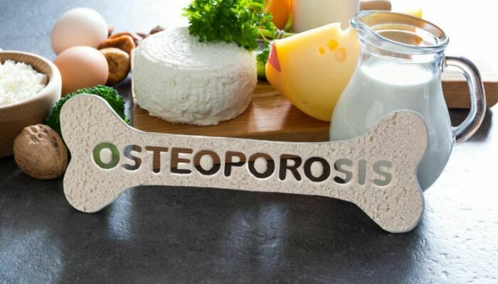 Prevenzione Osteoporosi 02
